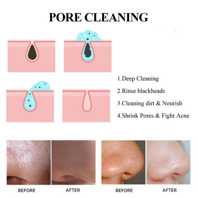 Blackhead Cleaning Mud Film Reduces Acne Marks And Blackheads