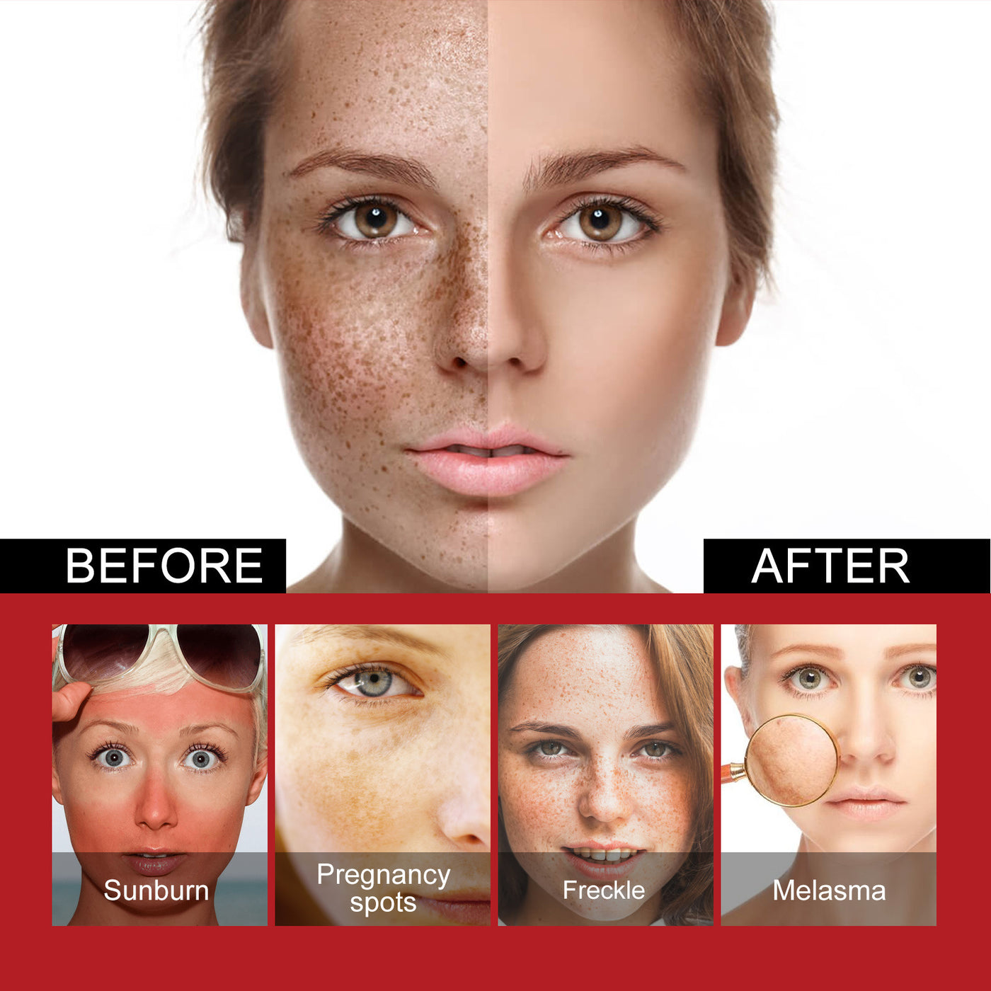 Repair Facial Dark Spots And Freckles