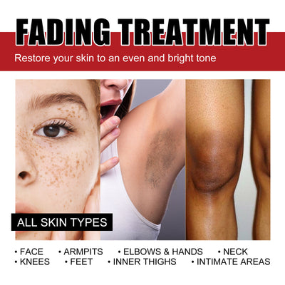 Repair Facial Dark Spots And Freckles