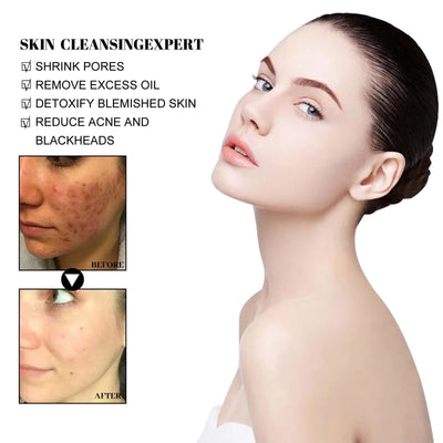 Blackhead Cleaning Mud Film Reduces Acne Marks And Blackheads