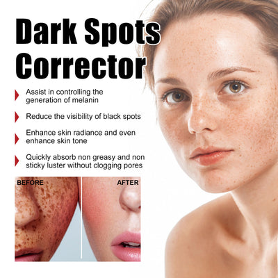Repair Facial Dark Spots And Freckles